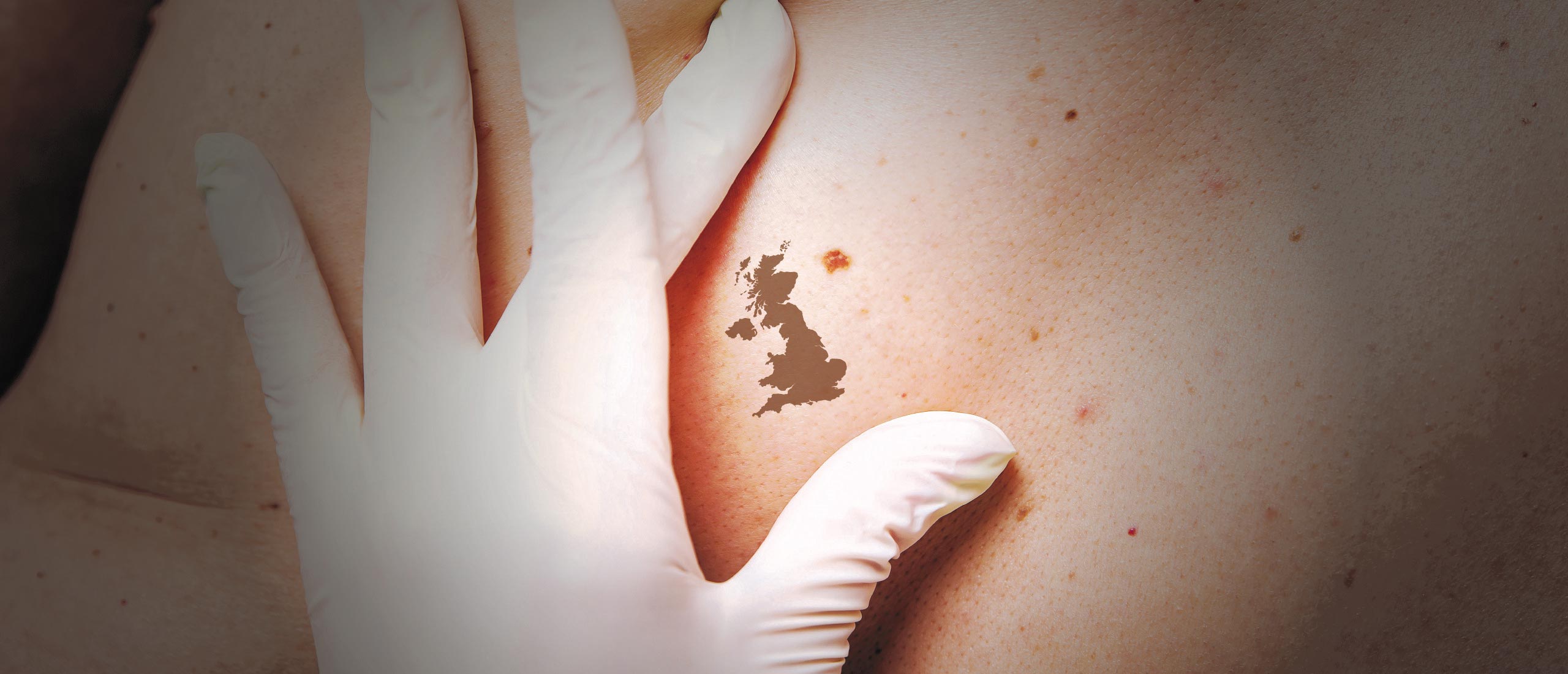 Mole shaped like Great Britain