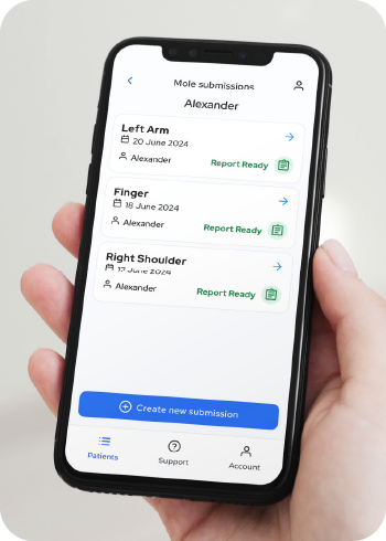 Map My Mole app on phone