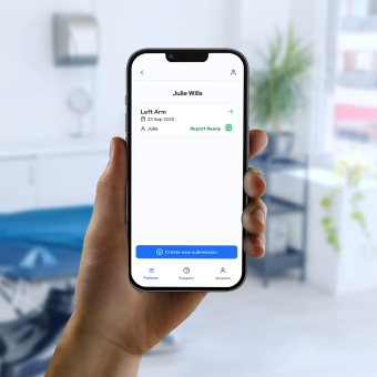 Map My Mole app on phone